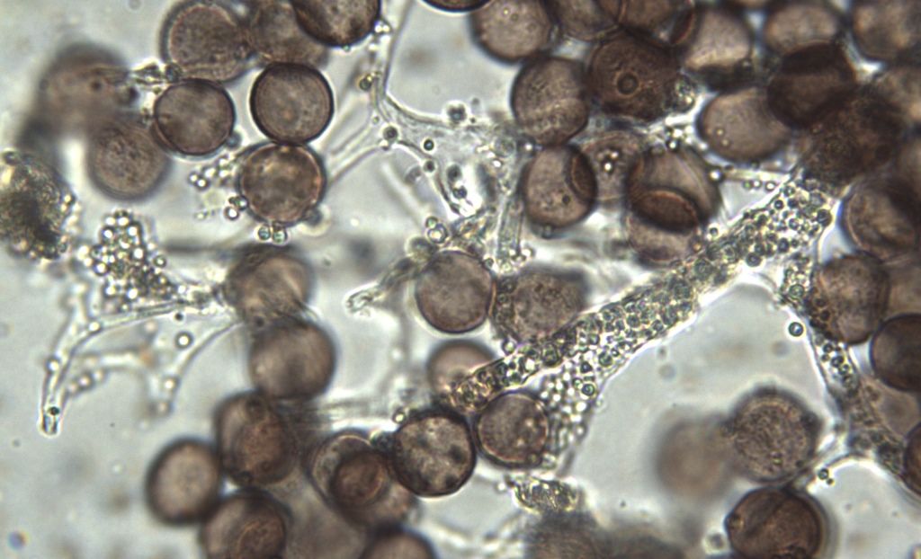 Physarum cf pusillum